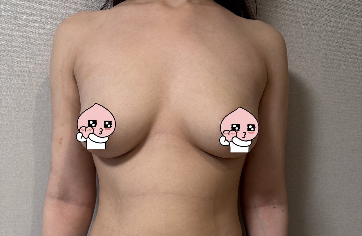 수술후기이미지