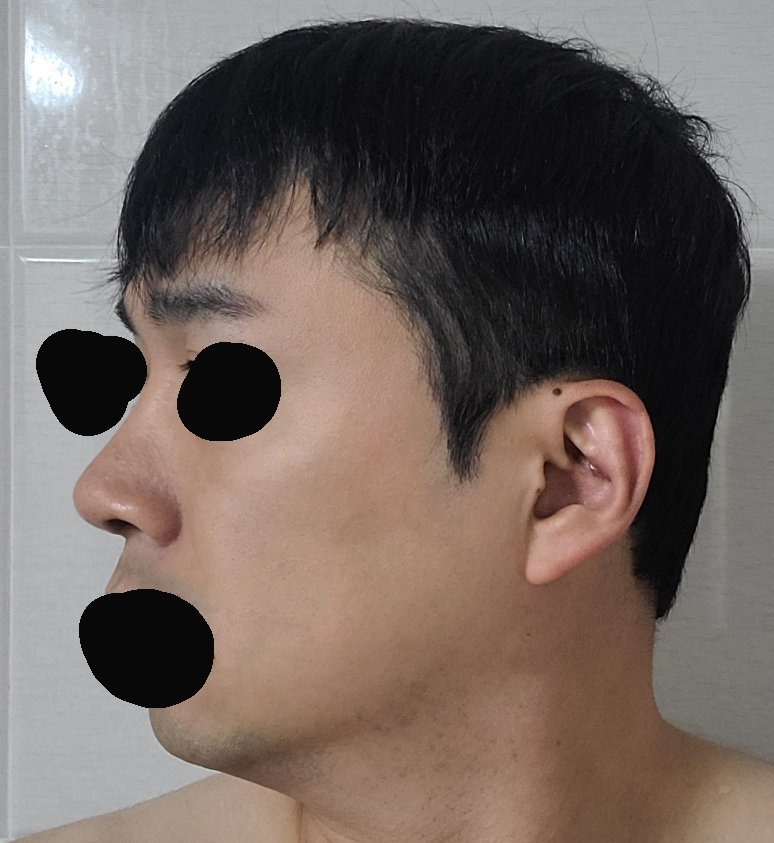 수술후기이미지