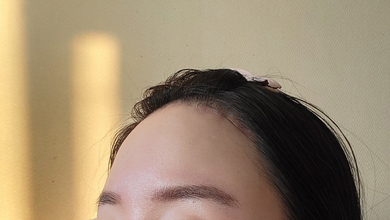 수술후기이미지