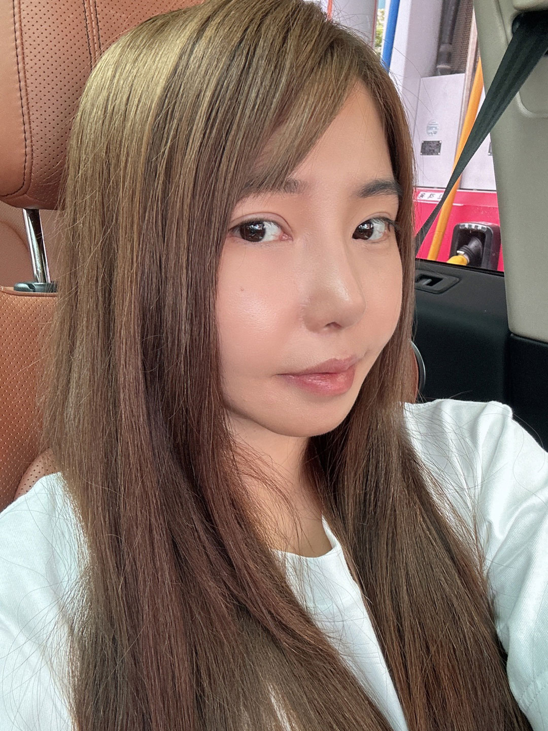 수술후기이미지