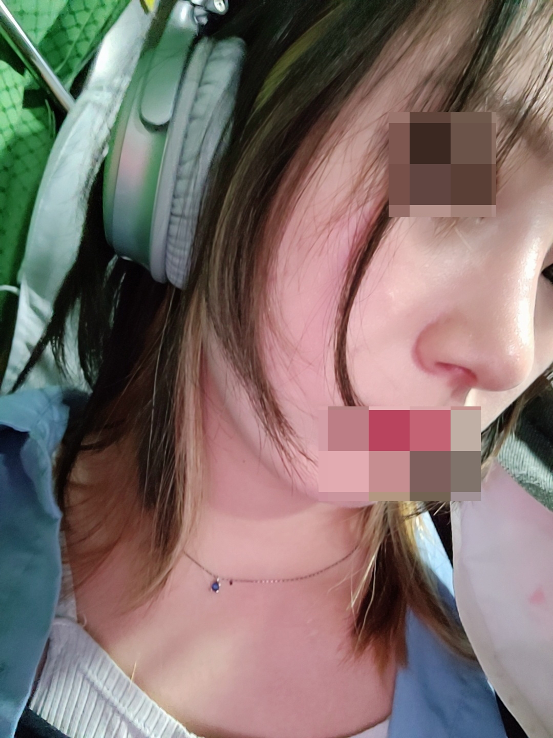 수술후기이미지