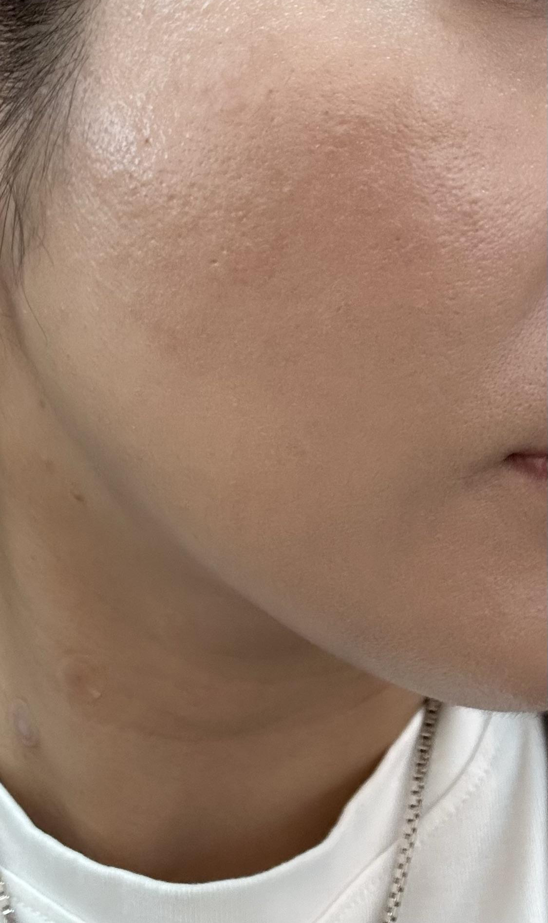 수술후기이미지