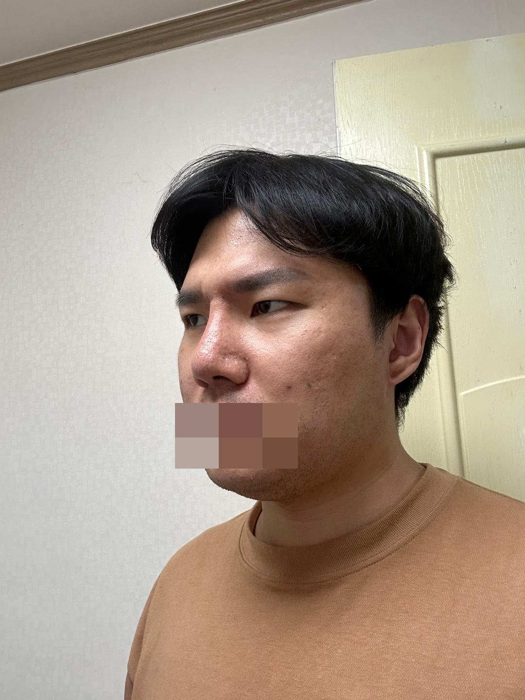 수술후기이미지