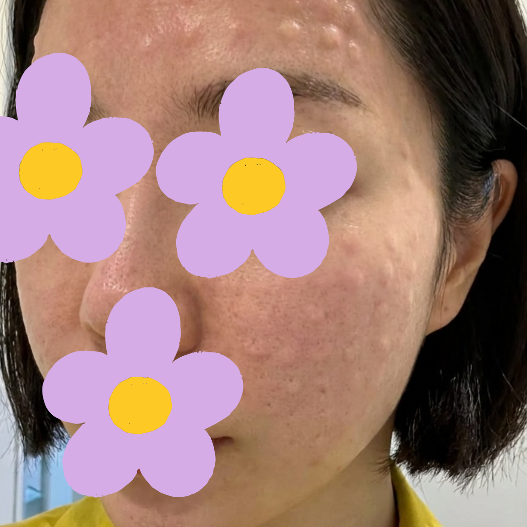 수술후기이미지