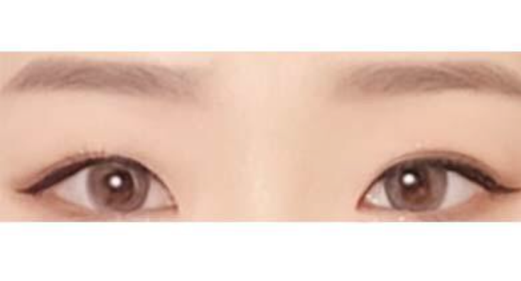 수술후기이미지