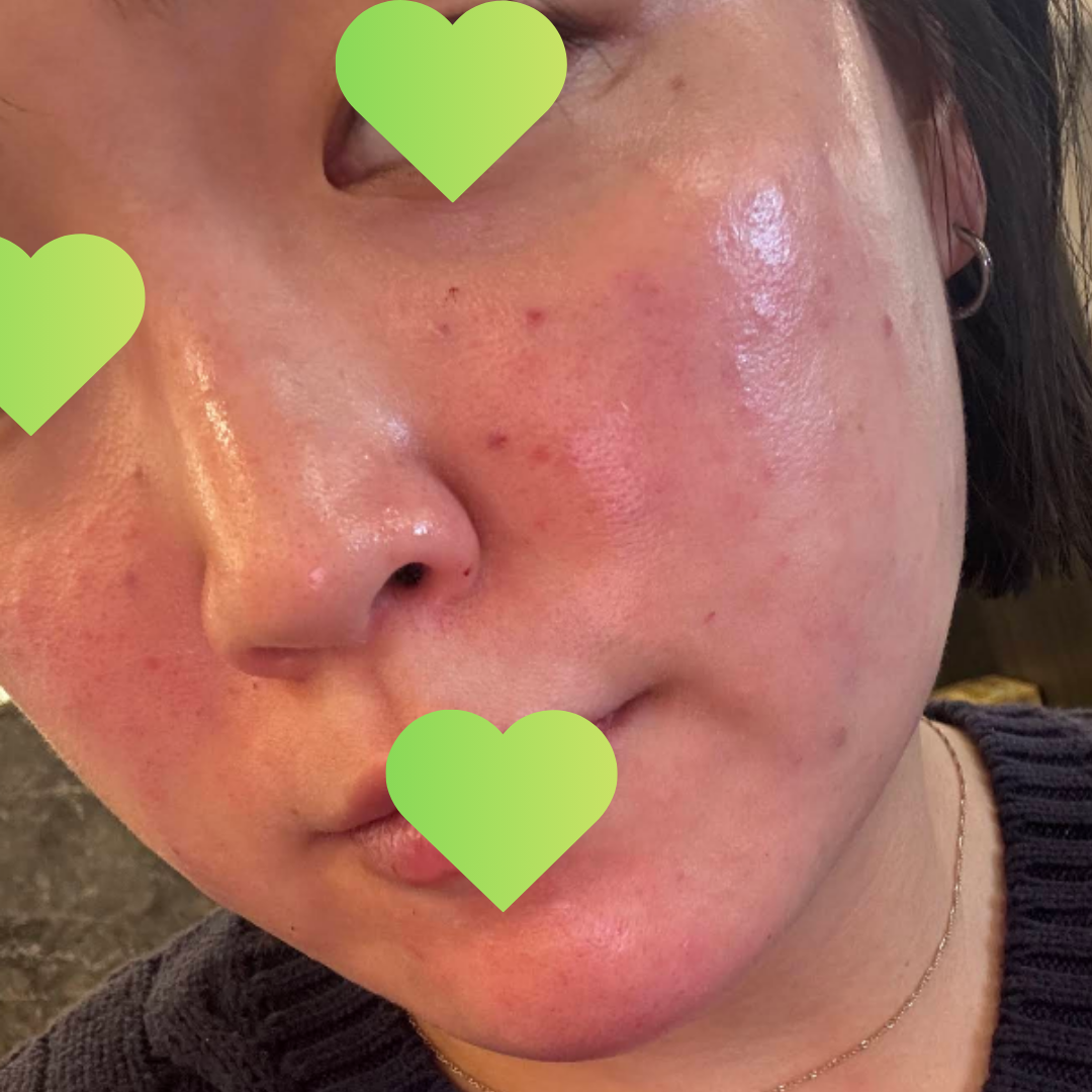 수술후기이미지