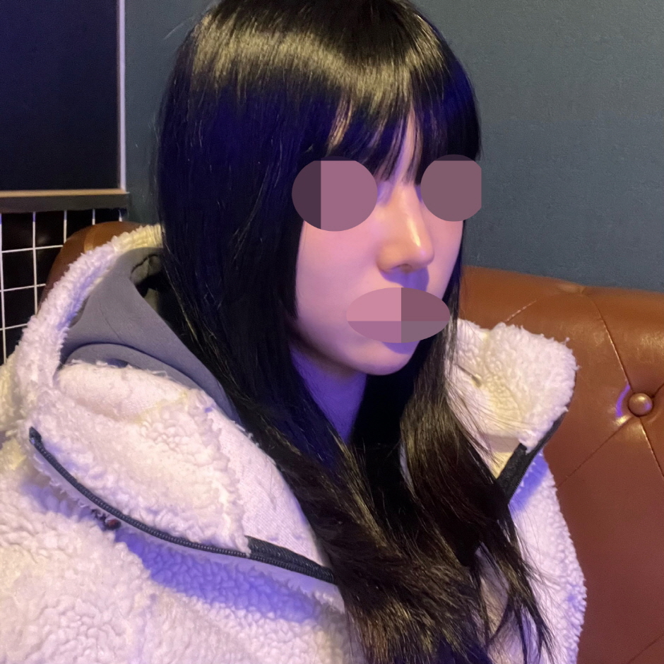 수술후기이미지