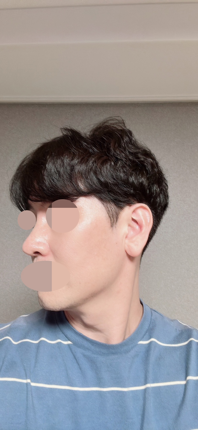 수술후기이미지