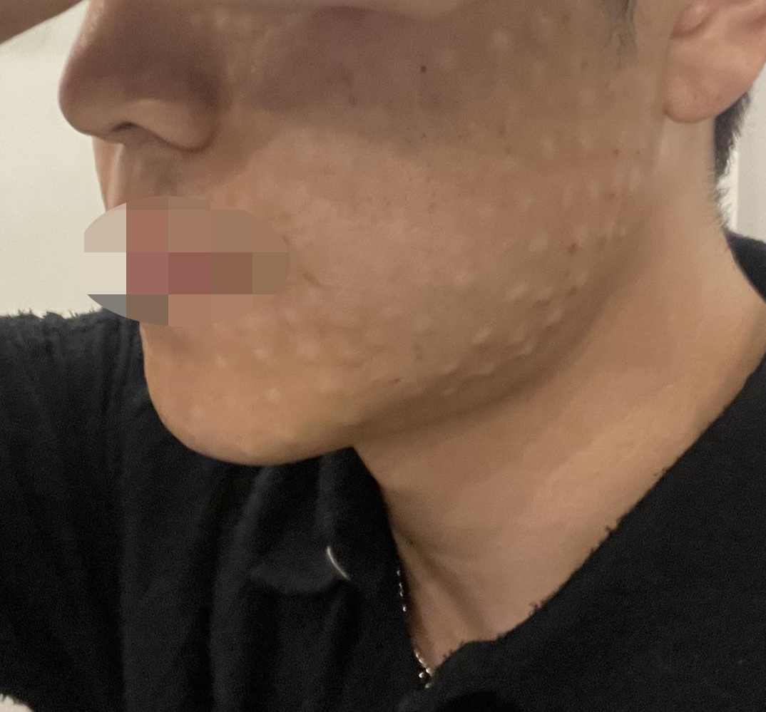 수술후기이미지