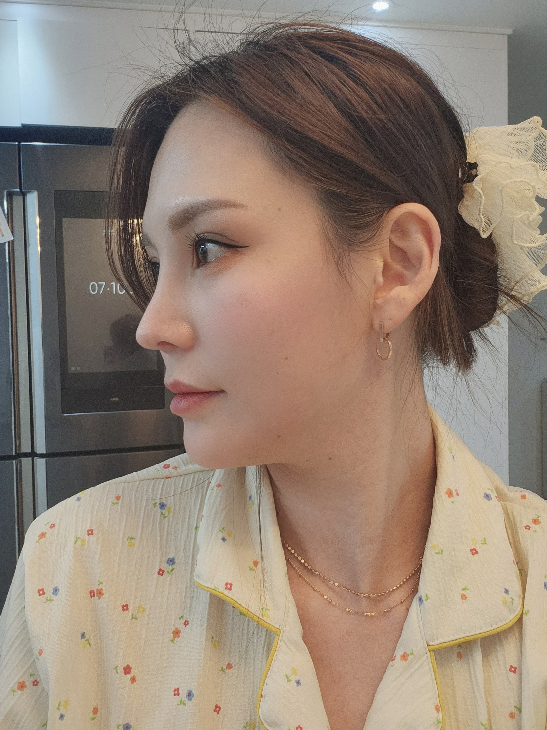 수술후기이미지