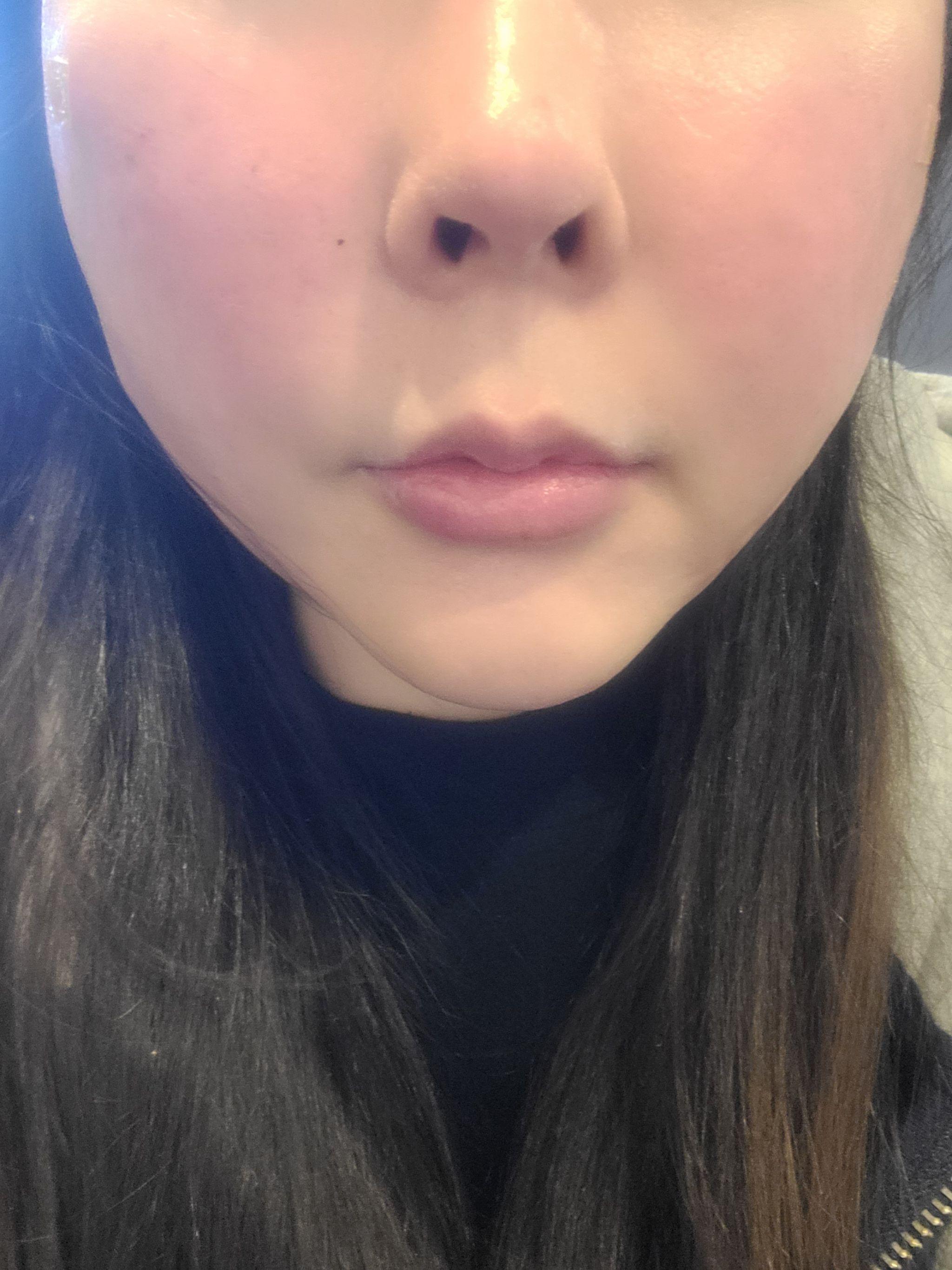 수술후기이미지