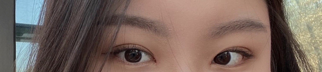 수술후기이미지