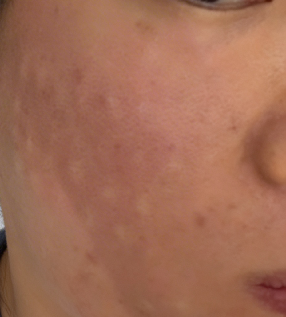 수술후기이미지