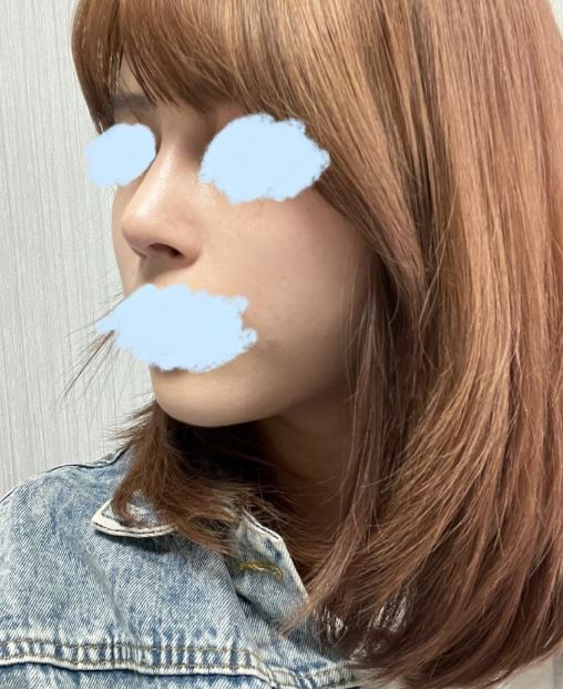 수술후기이미지