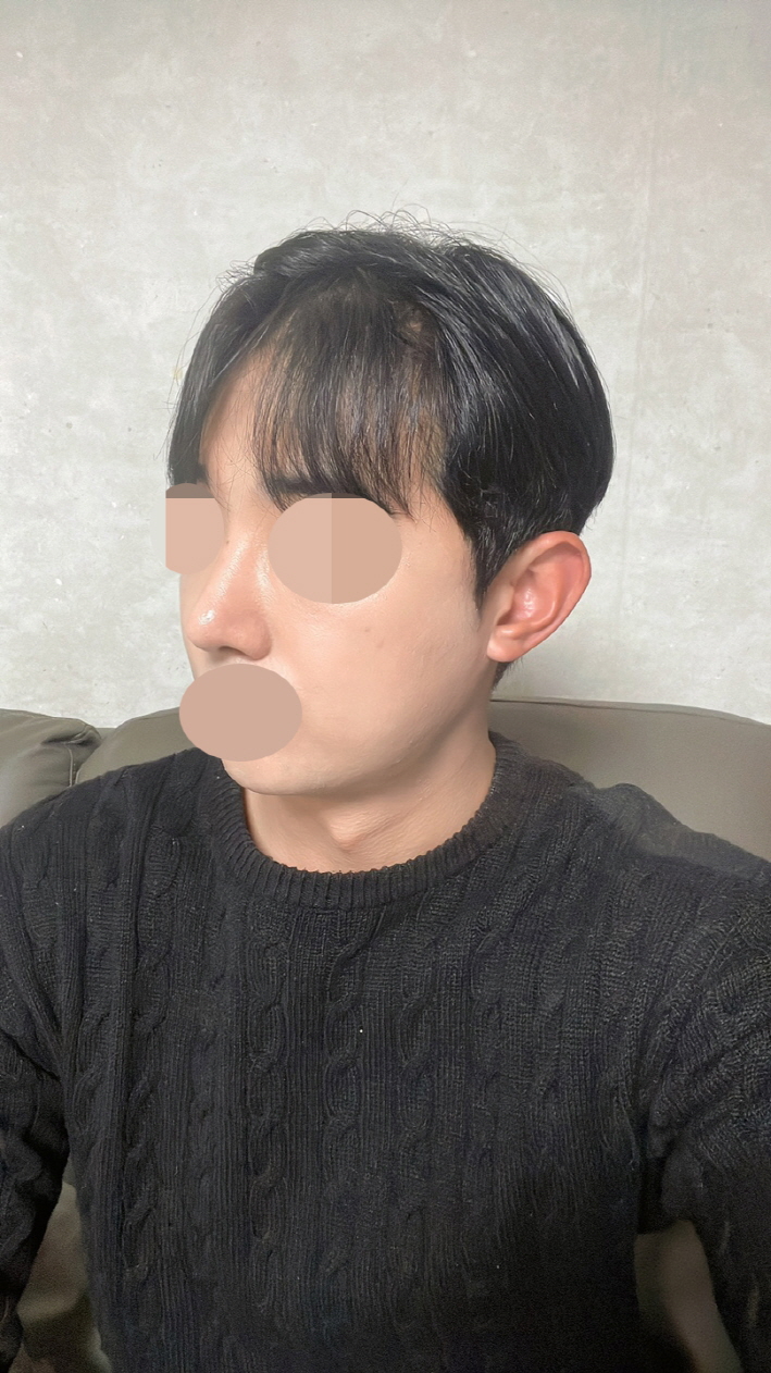 수술후기이미지