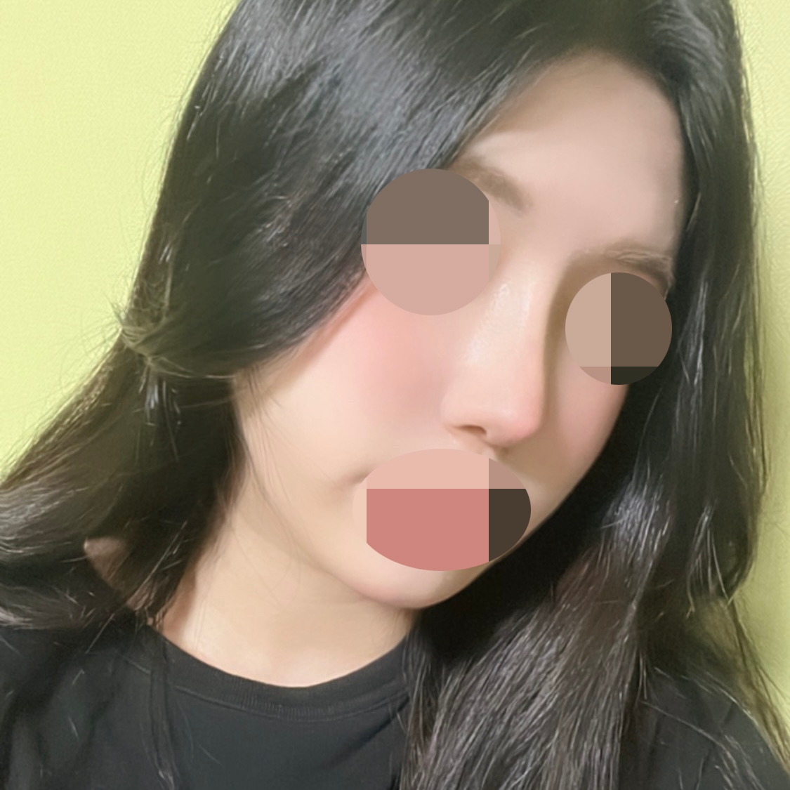 수술후기이미지