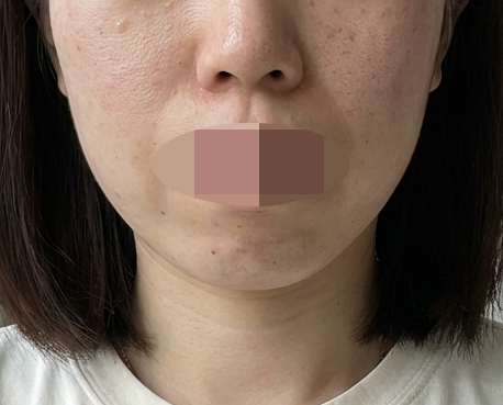 수술후기이미지