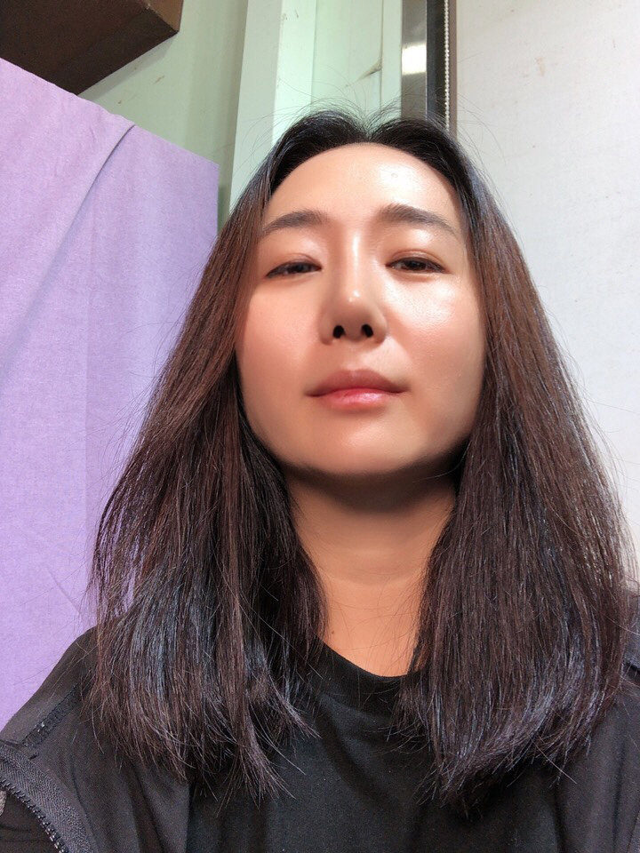 수술후기이미지