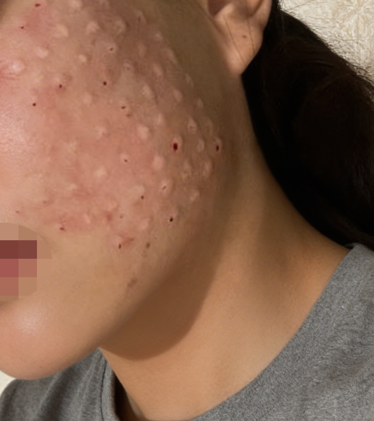 수술후기이미지