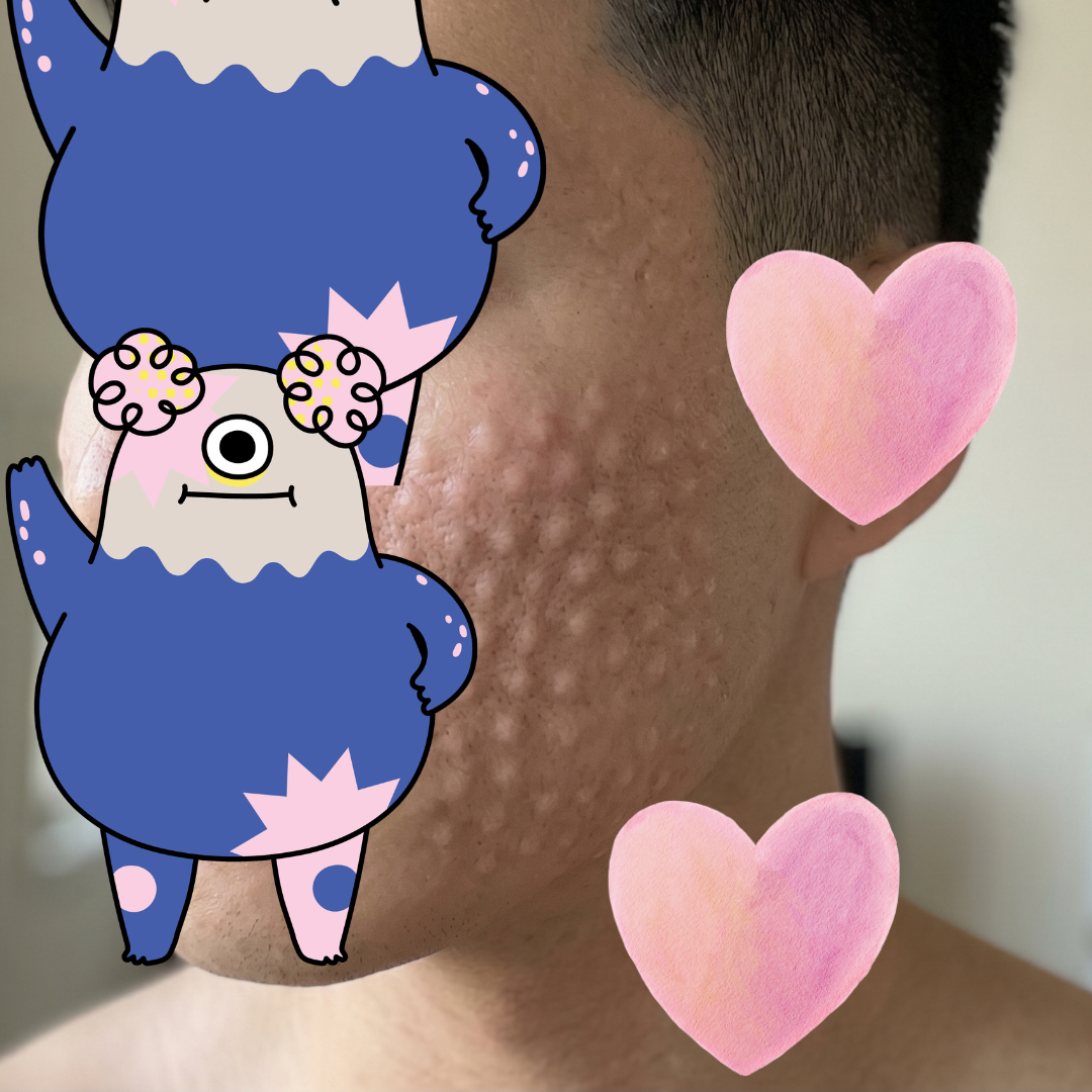 수술후기이미지