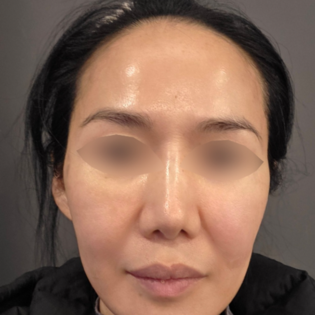 수술후기이미지