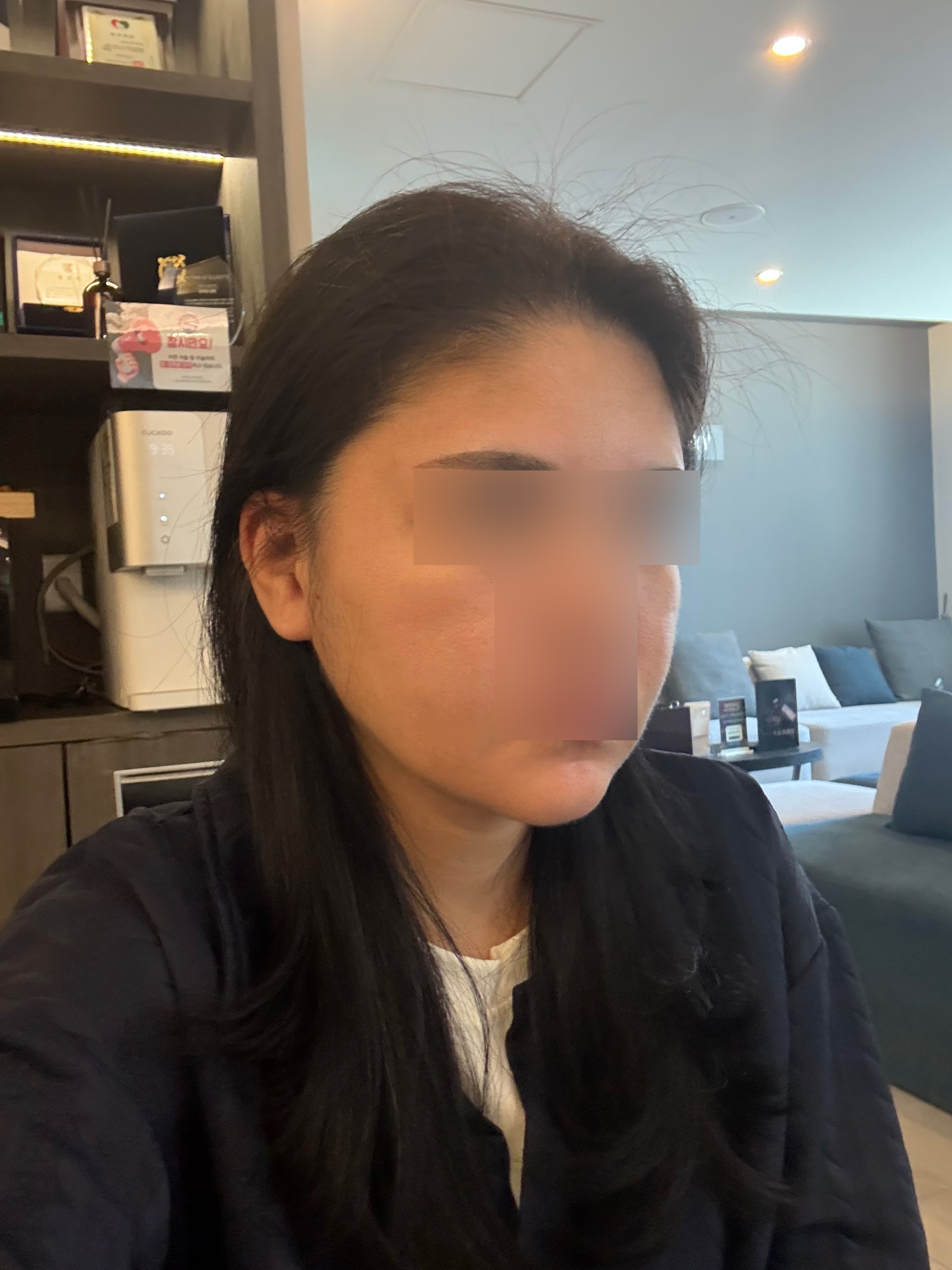 수술후기이미지