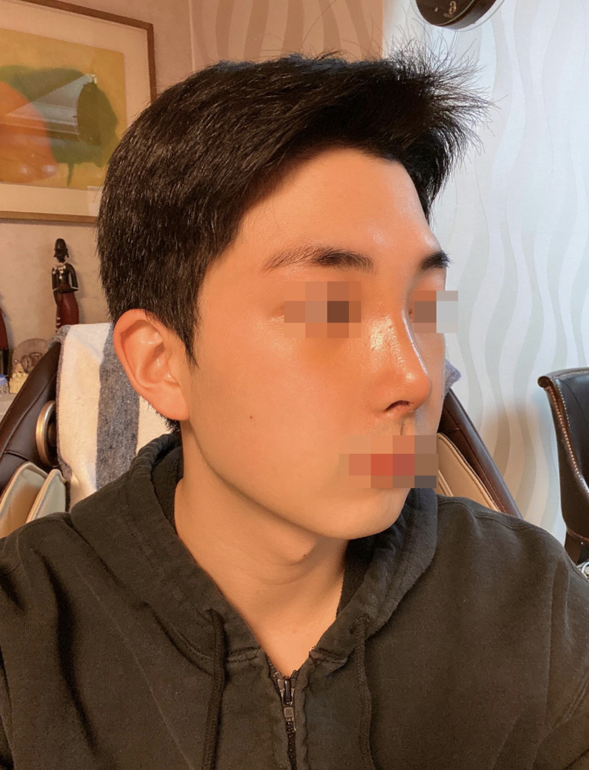 수술후기이미지