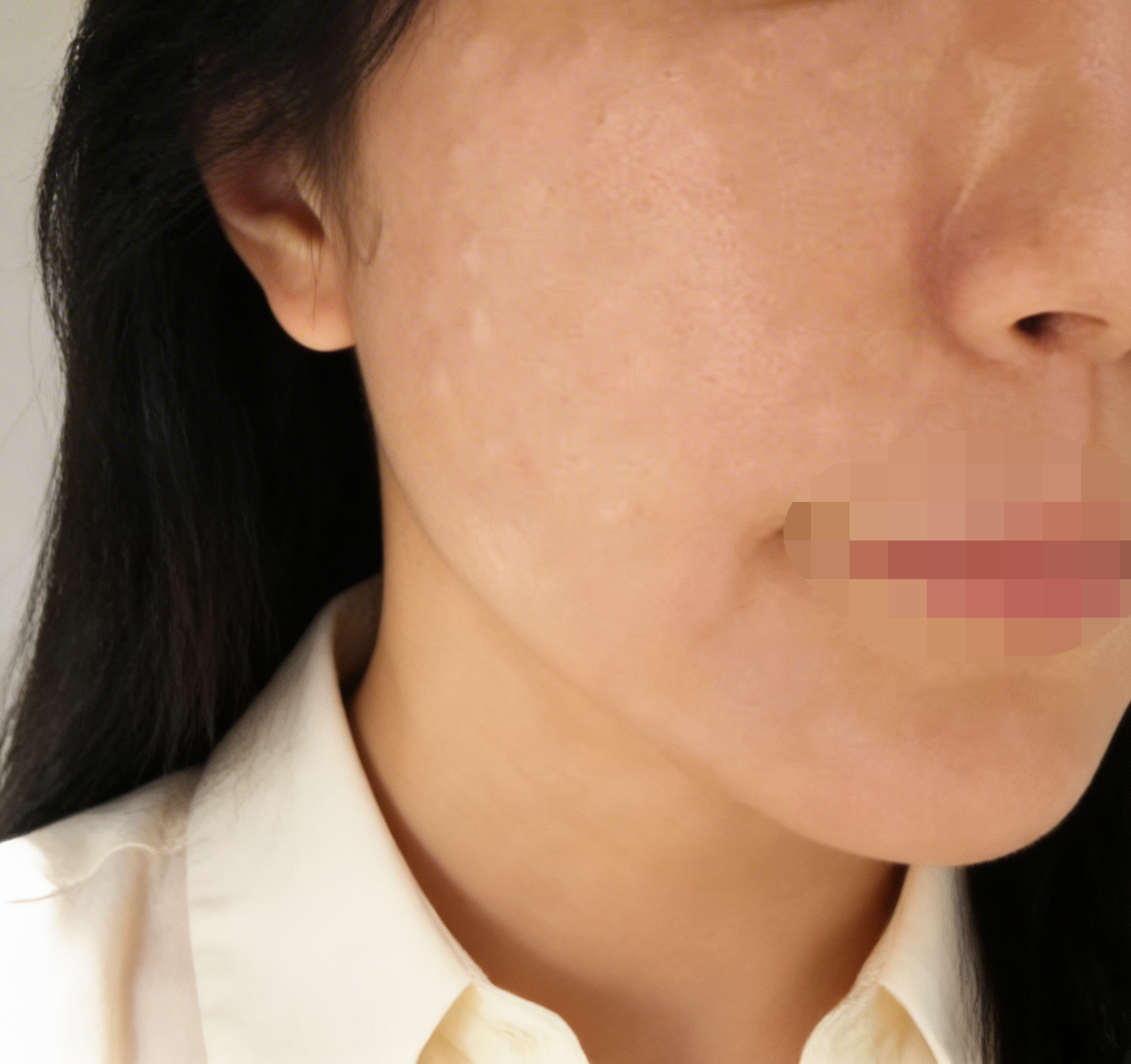 수술후기이미지