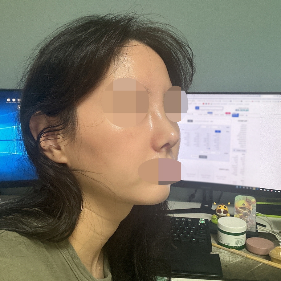 수술후기이미지