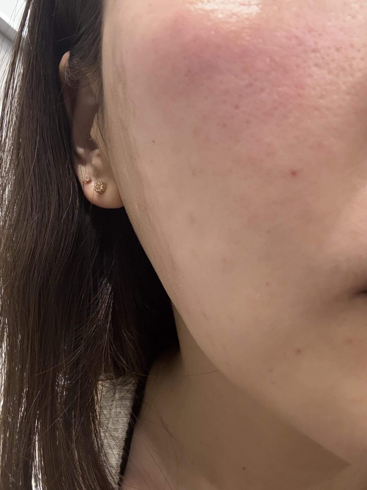 수술후기이미지