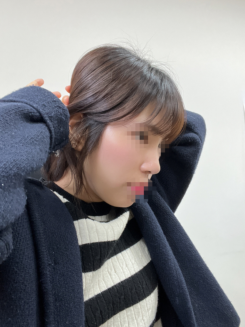 수술후기이미지