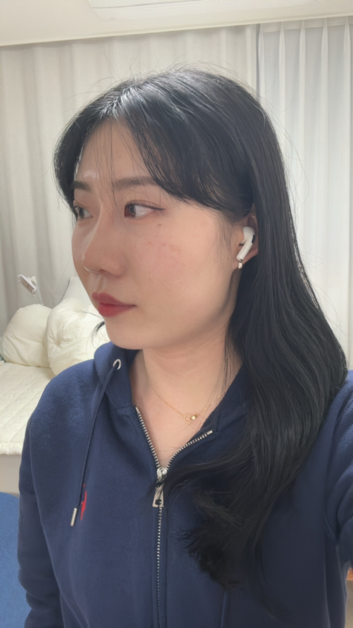 수술후기이미지