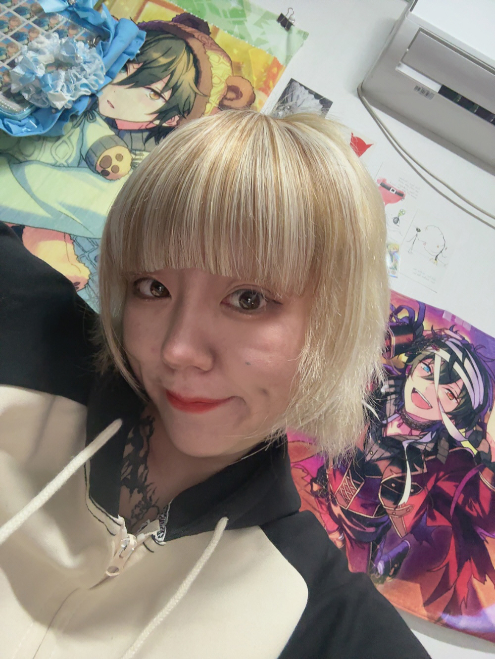 수술후기이미지