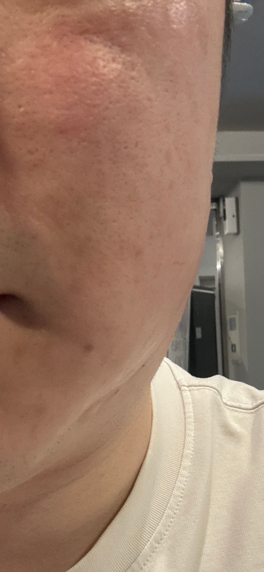 수술후기이미지