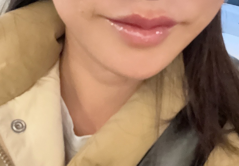 수술후기이미지