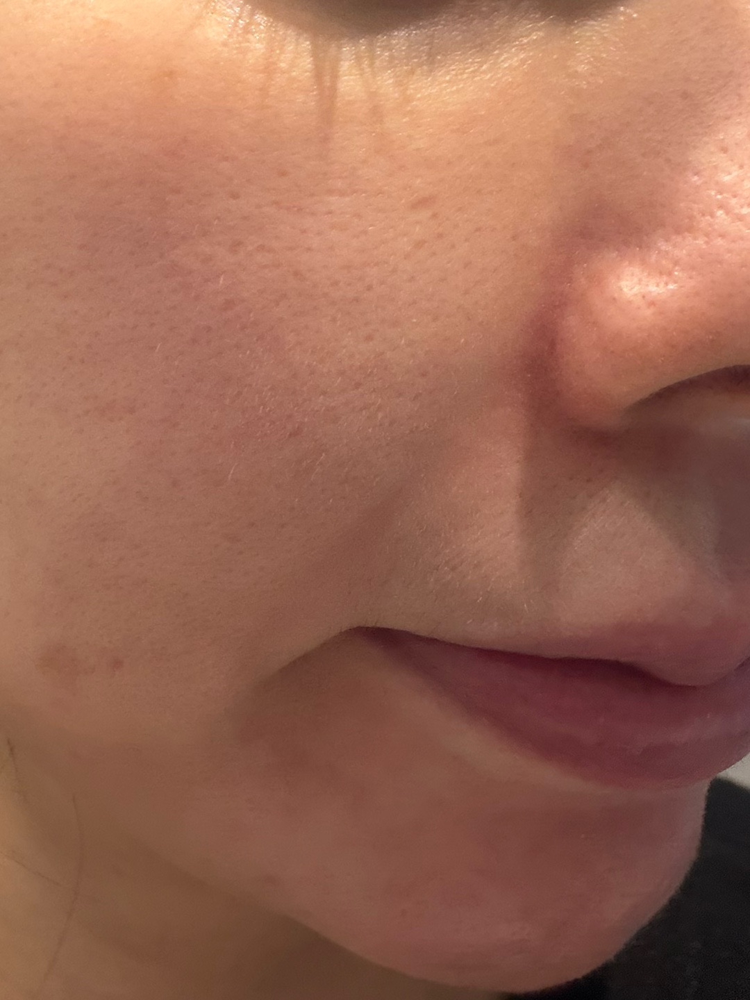 수술후기이미지