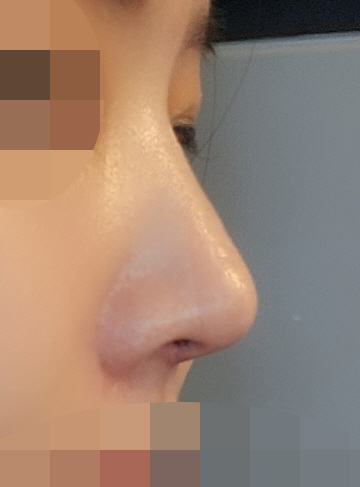 수술후기이미지