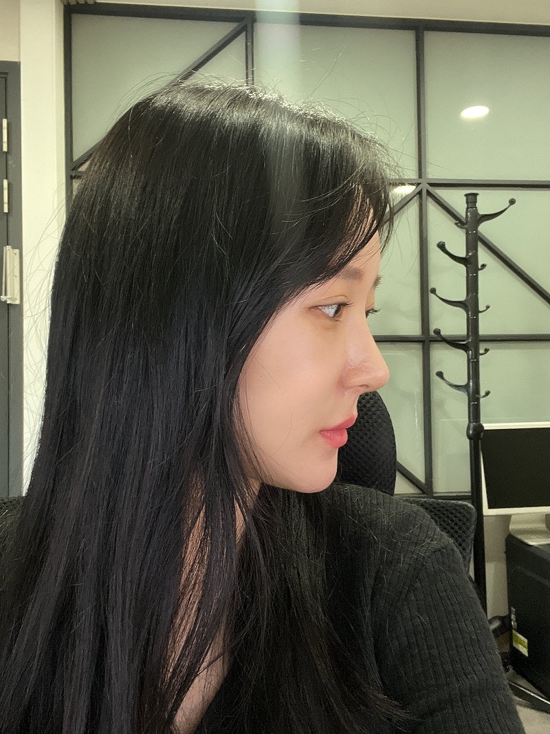 수술후기이미지