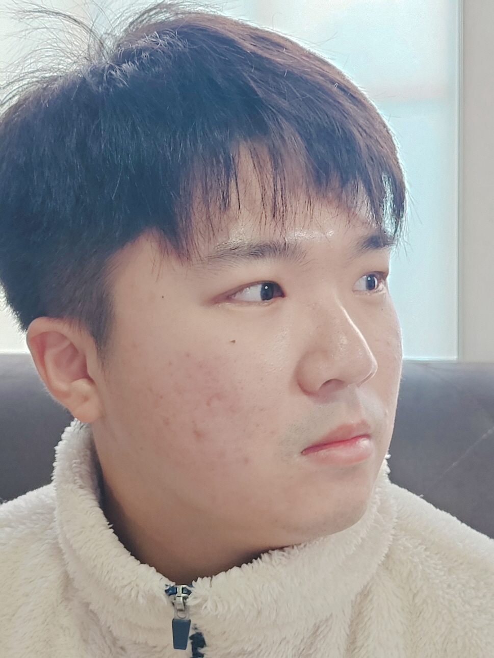 수술후기이미지