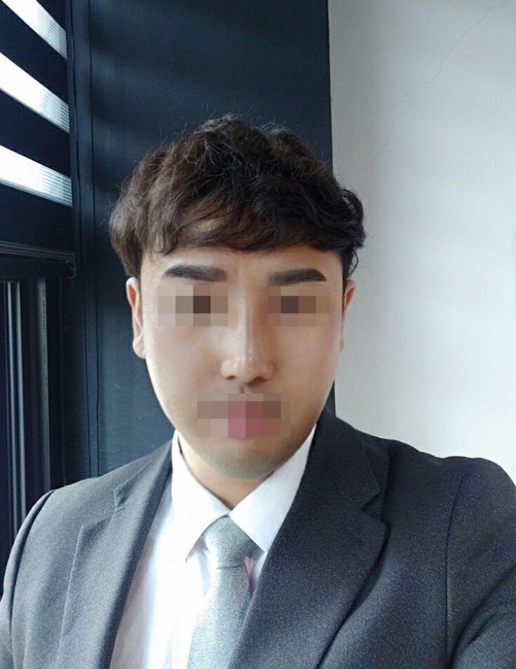 수술후기이미지