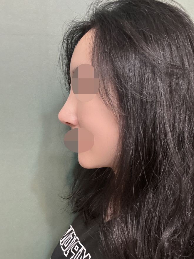 수술후기이미지