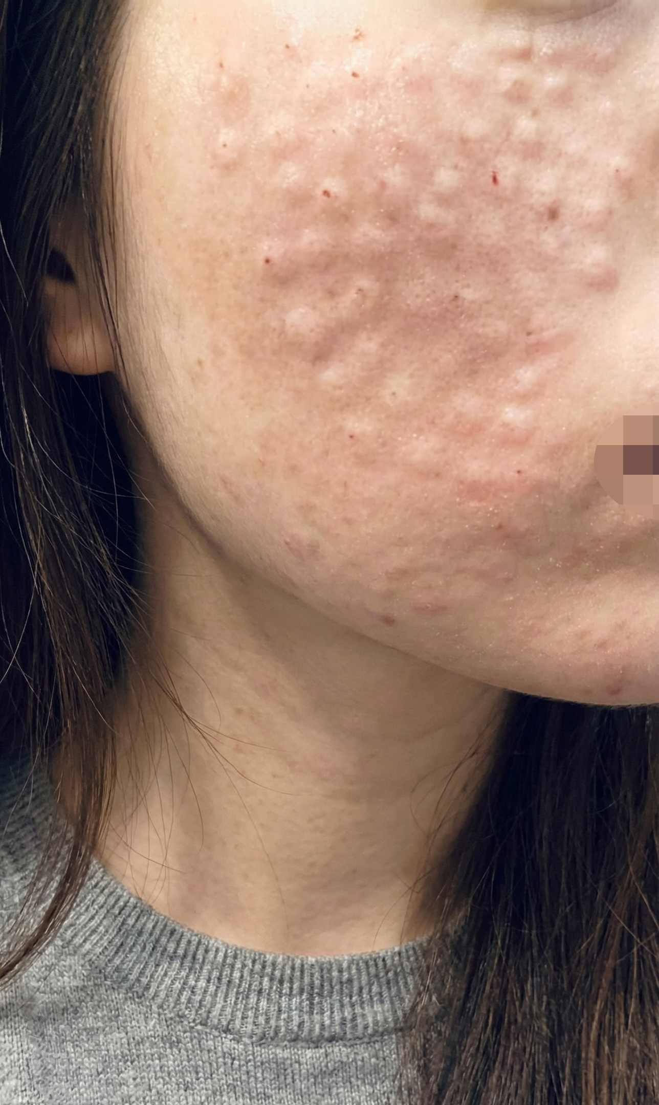 수술후기이미지