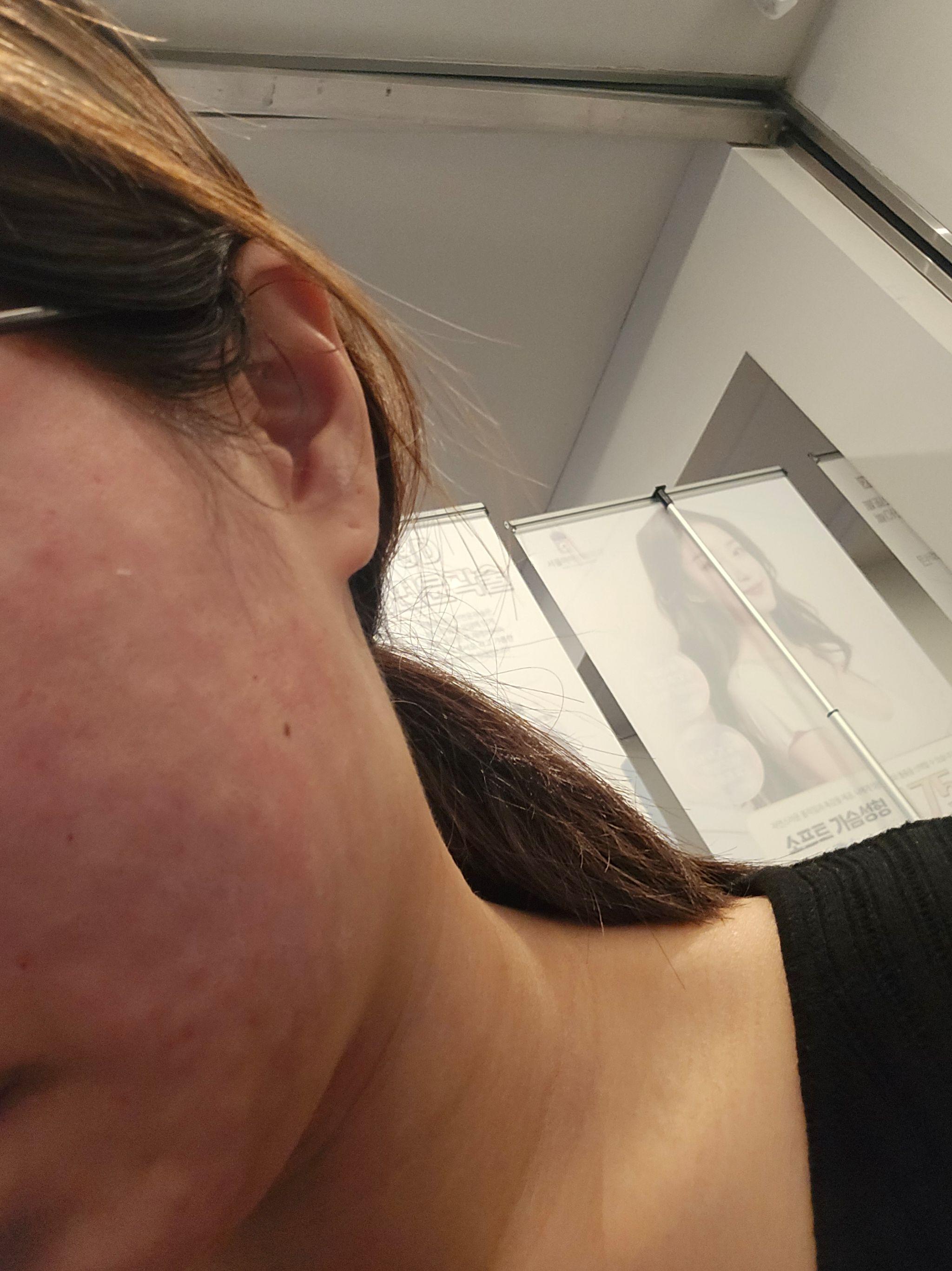 수술후기이미지