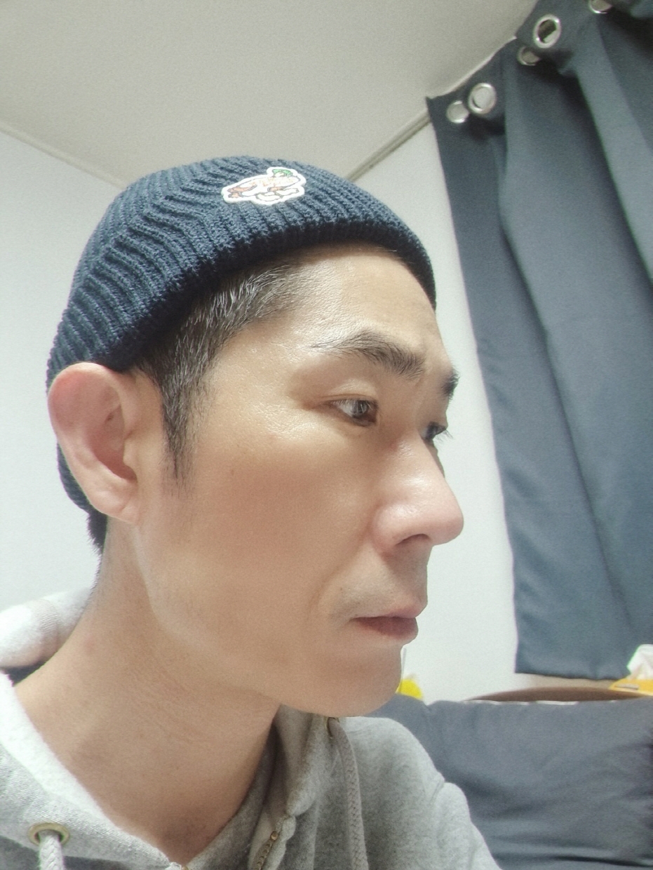 수술후기이미지