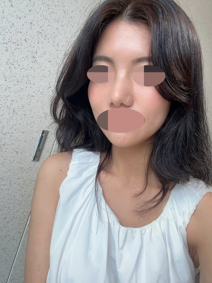 수술후기이미지