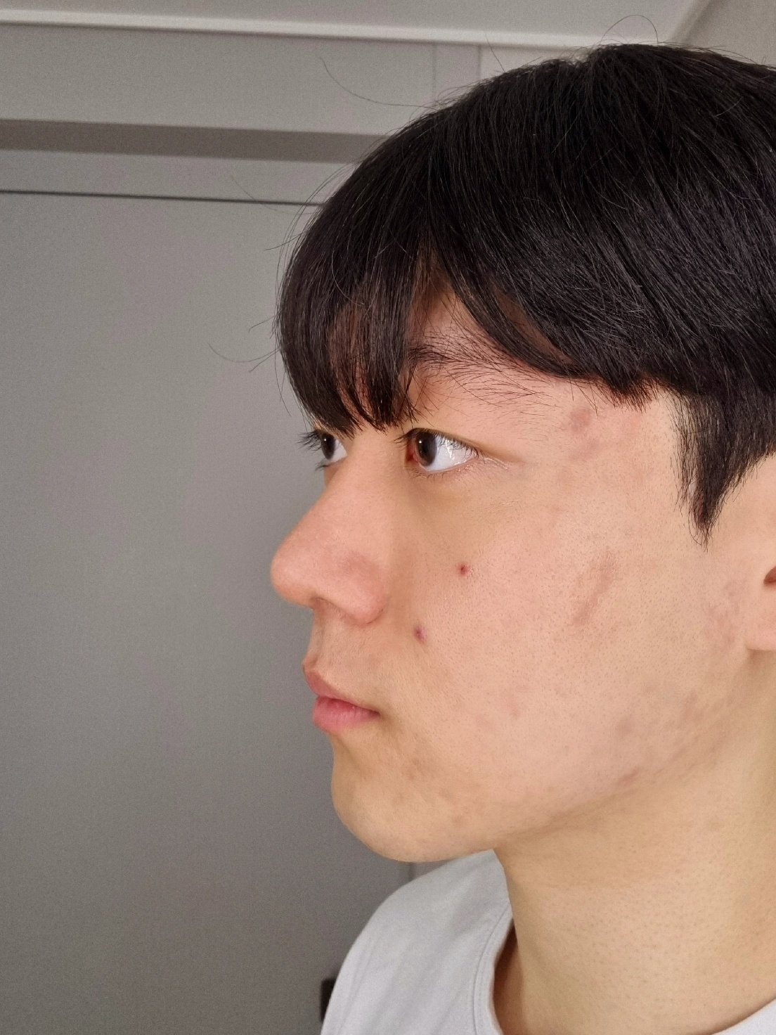 수술후기이미지