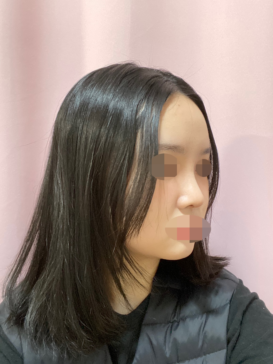 수술후기이미지