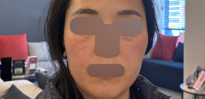 수술후기이미지