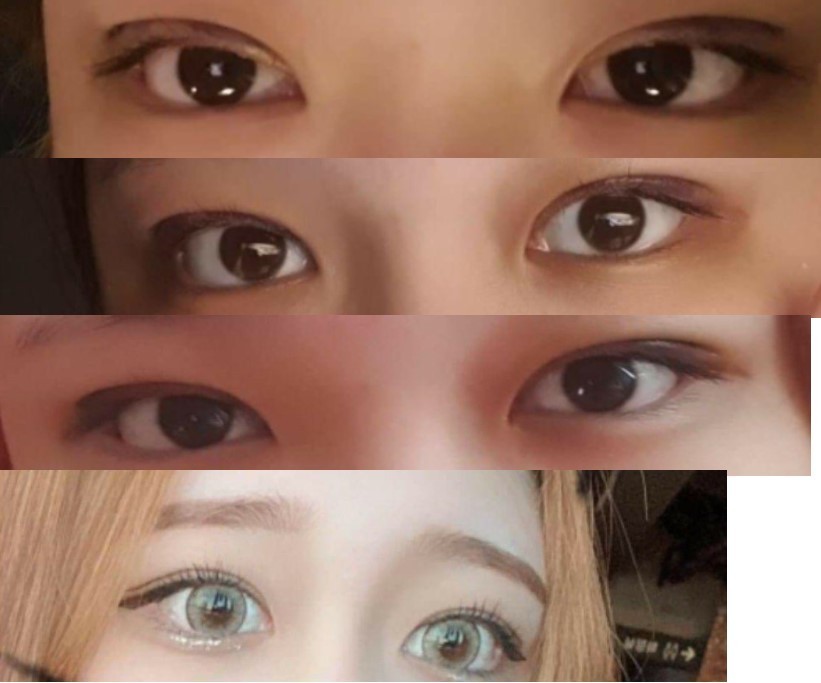 수술후기이미지