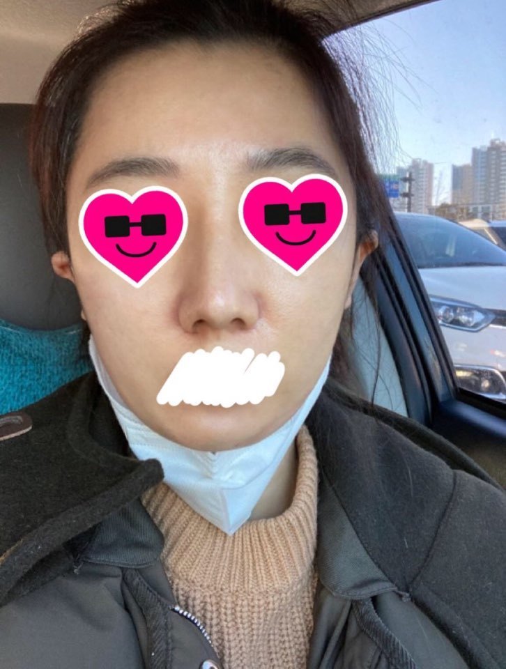 수술후기이미지